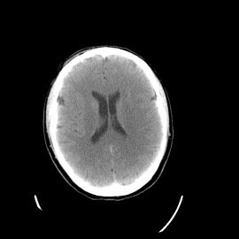 Cancro: la cura di Salvatore Iaconesi