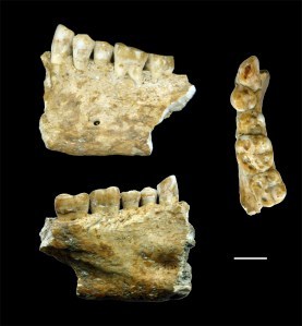 Nel Neolitico l'odontoiatra curava con la cera d'api