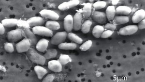 Batteri all'arsenico: Rosie Redfield pubblica su Science