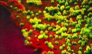 Metodi naturali per curare l'influenza suina H1N1