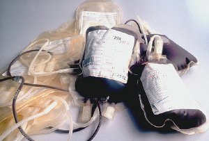 Sangue infetto: per non dimenticare