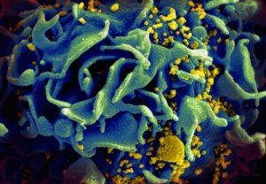 Un anticorpo per trattare i malati di HIV
