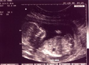 Aborto. Tra libertà di scelta e diritto alla vita