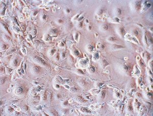 "L'eterna giovinezza": un sogno?