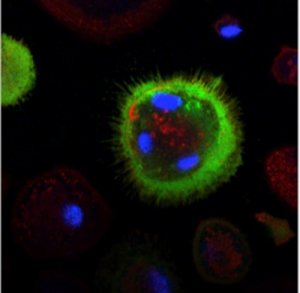 HIV, individuati due nuovi bersagli