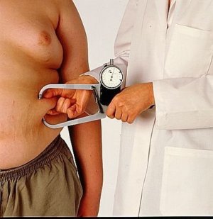 Obesità... il grasso che accorcia la vita!
