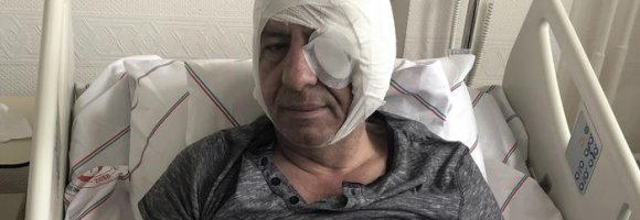 Turchia, bastonare il pensiero critico 