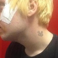Ragazzo gay aggredito 