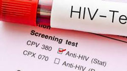 Test HIV