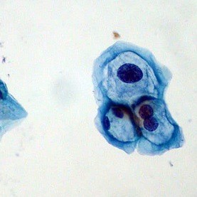 Lui, lei e il papillomavirus