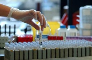 Nuove frontiere della cura del cancro: teranostica e nanoparticelle
