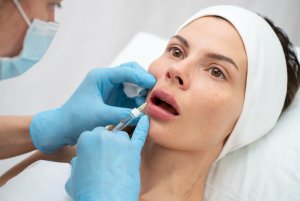 lipofiller labbra