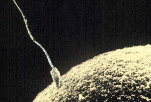 Fecondazione assistita: niente diagnosi per le coppie portatrici di malattie genetiche