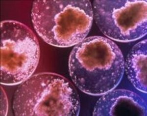 Cellule staminali: dibattiti e testimonianze