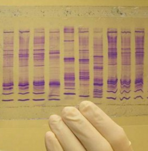 Tumori: in arrivo nuovi test "Biopsia liquida"