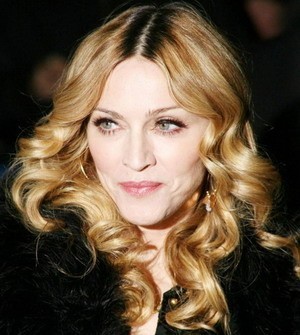 Madonna: su facebook le foto dei lividi per la caduta durante le prove del tour