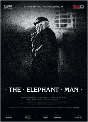 The elephant man