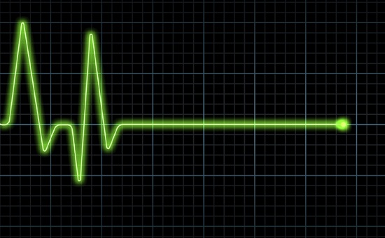 ecg